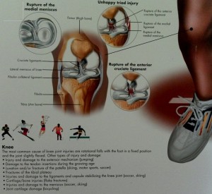 Common sports injuries on the knee