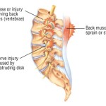 back pain1